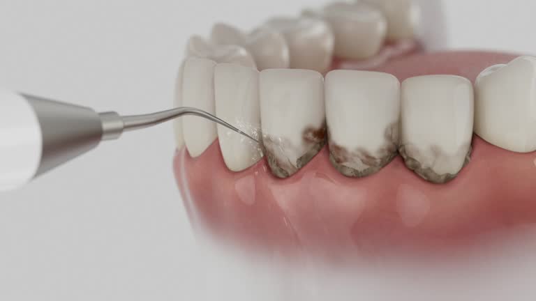 Reliable Dental contractor in Baywood Park, CA by Dentist Open Now
